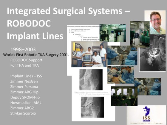 ROBODOC implant lines slide